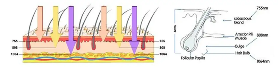 Diyot Lazer özellikler