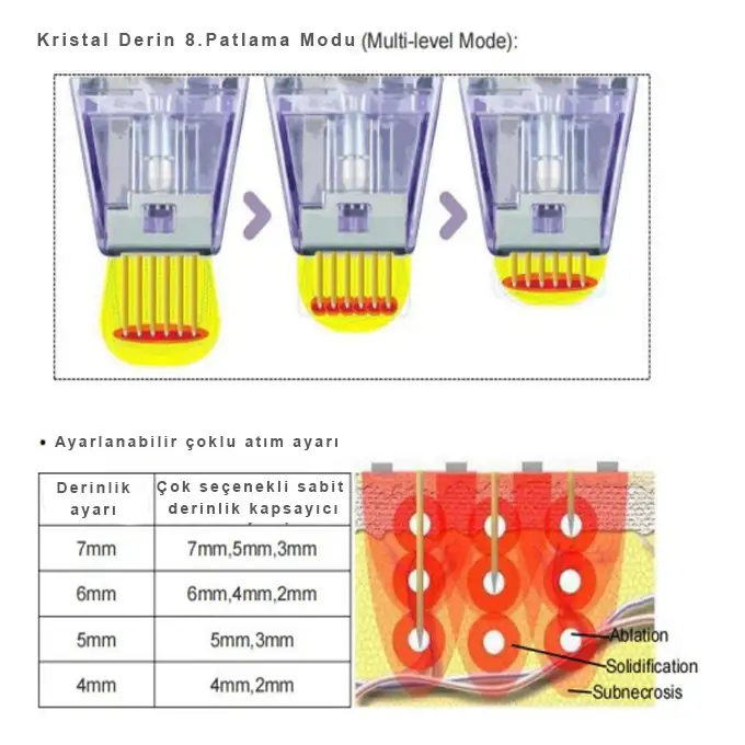 Needle micro igne modu
