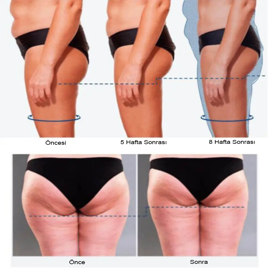 Hemslimmer vücut şekillendirici